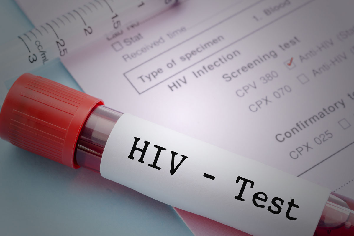 hiv-test